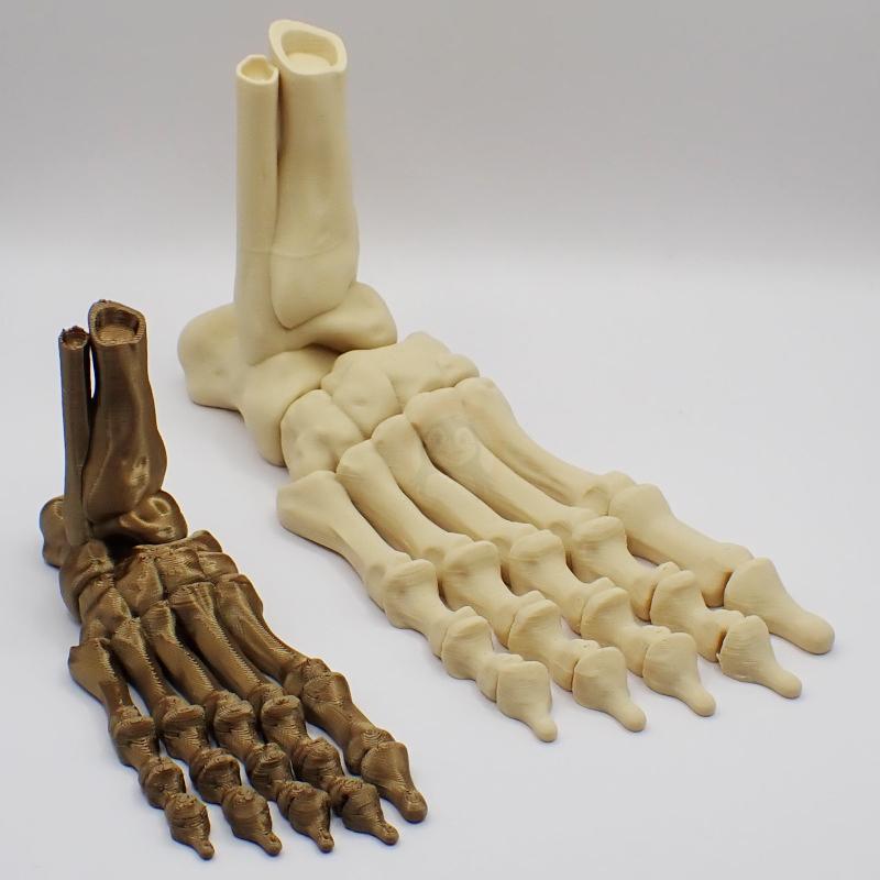 Noha kostlivce pravá