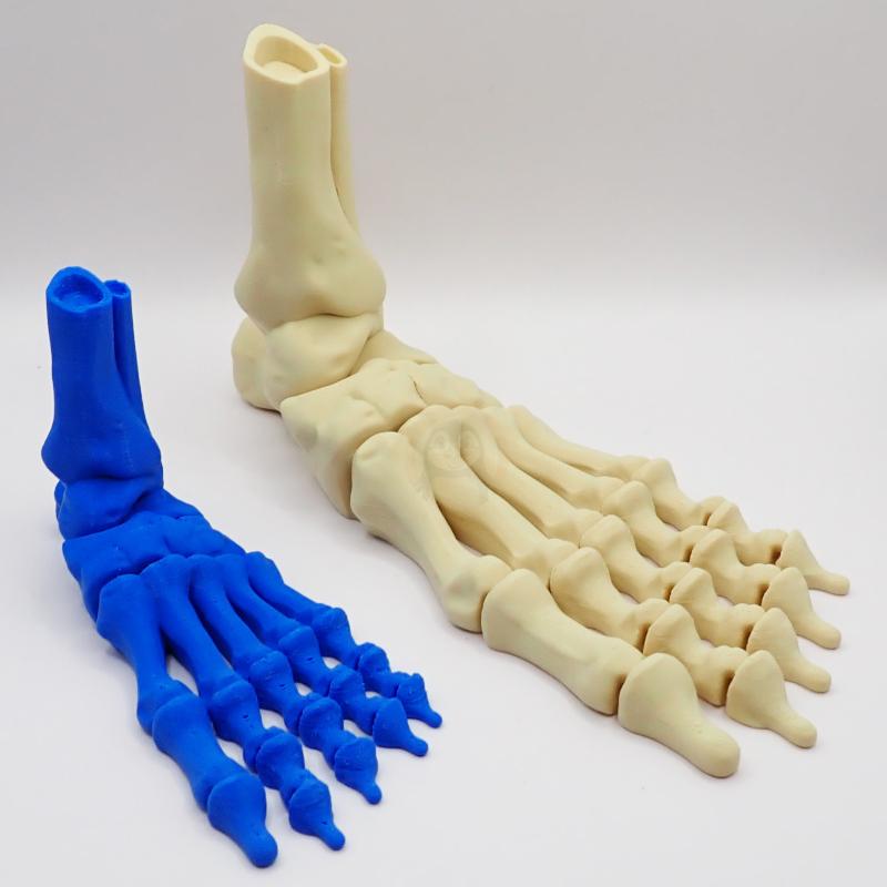 Noha kostlivce levá