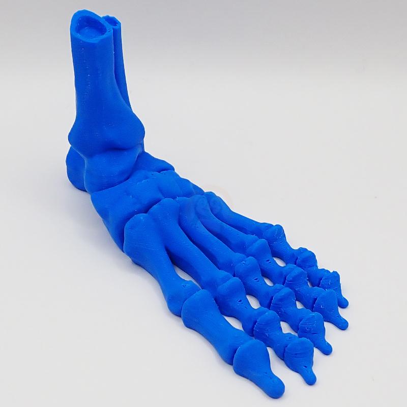 Noha kostlivce levá